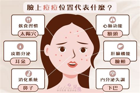 痘痘位子|痘痘一直好不了？痘痘位置代表什麼？醫師2招治療痘。